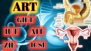 ART , IVF , IUT , ZIFT , GIFT , AIT , ICSI || Assisted Reproducctive Technique | Unstudy Classes ||