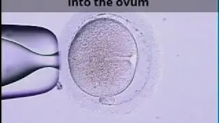 IVF at Vindana Reproductive Health Centre - Colombo 7, Sri Lanka