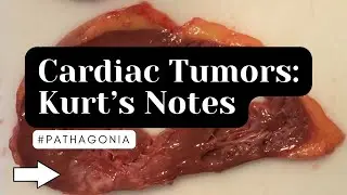 Cardiac Pathology: Kurt’s Notes #pathagonia