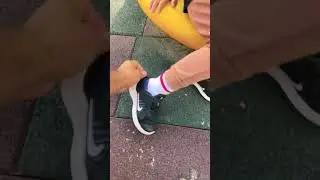 Onur un ayağına ayakkabı vurmuş 