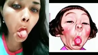 Muka jelek 