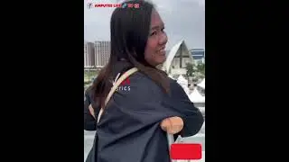 Amputee lady adaptive crutches user: life after amputation exploring daily activities 19