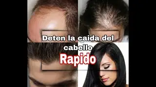 HOW TO STOP HAIR LOSS/HOW TO GROW LONG HAIR