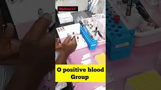 O positive blood group | abo blood group| #shorts #doctorsvlog #dayinthelife #viral #vlog #medical