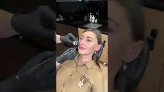 Инъекции ботокса в прямом эфире. Live botox injections. 