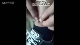 ბიჭმა ტყვია ფეხიდან საკუთარი ხელით ამოიღო -  სუსტი გულის პატონებმა არ ნახოთ