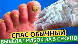 Грибок Ногтей НАВСЕГДА Исчезнет За 5 секунд, Поможет Этот Способ! Лечение Грибка Ногтей ЛЕГКО!