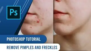 How to Remove Pimples and Freckles in Photoshop