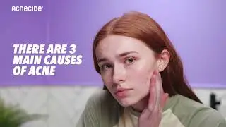Acne Awareness Month - Acnecide Targets Them All