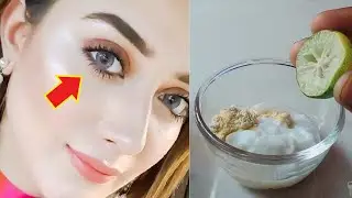 علل سیاهی دور چشم و راههای درمان دائم سیاهی و کبودی اطراف چشم
