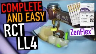 SIMPLE RCT CASE - ZenFlex | 4k Resolution