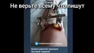 Лечат ли солдат РФ