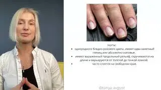 Типы ногтей