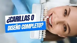 ¿Carillas o diseño de sonrisa completo? Conoce la mejor opción / Odontoespecialistas