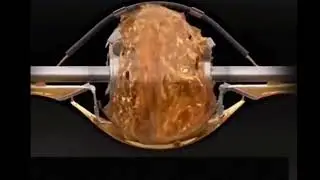 Funcionamiento del lubricante en el diferencial