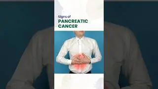 Signs of Pancreas Cancer