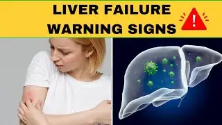 10 Signs Your Liver Might be in Trouble | Health is Wealth