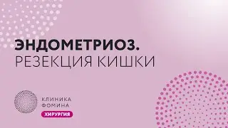 эндометриоз: резекция кишки