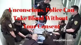Unconscious Blood Draws are NOW Legal: Supreme Court Case: Mitchell v Wisconsin