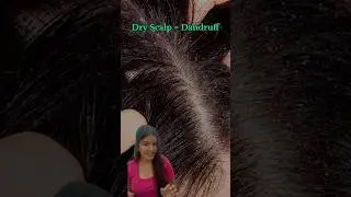 Perfect solution for your dry scalp🌼🤌🏻 #dandruff #dandrufftreatment #pilgrim #shampoo #shorts