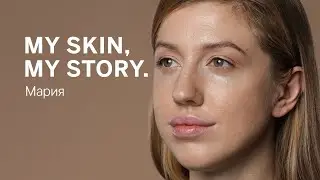 MY SKIN, MY STORY. – Мария