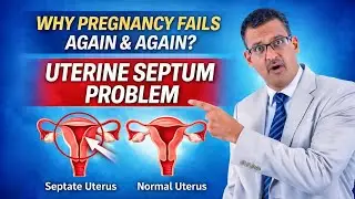 Septate Uterus Explained - Hidden Cause of Miscarriage & IVF Failure | बच्चेदानी में परदा?