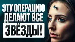 ЭТУ ОПЕРАЦИЮ ДЕЛАЮТ ВСЕ ЗВЕЗДЫ - Эндоскопическая подтяжка