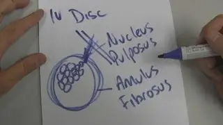 Intervertebral Disc