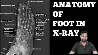 FULL DEPTH ANATOMY OF FOOT X-RAY. #xrayclasses #anatomy