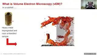 Exploring volume electron microscopy (vEM) and Transmission Electron Microscopy (TEM)