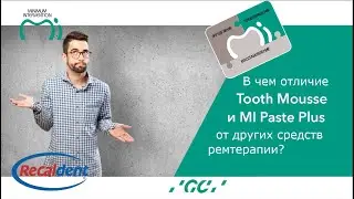 В чем отличие Tooth Mousse от других средств ремтерапии? #toothmousse #гигиеназубов #тусмусс