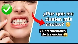 ✅ ¿Por que me duelen mis encias? / Enfermedades de las encías 👈😳