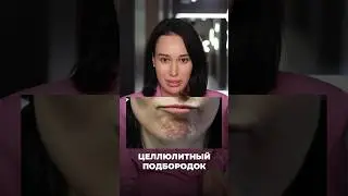 «Целлюлитный подбородок». проблема - решение. #косметологиямосква #клиникакосметологии