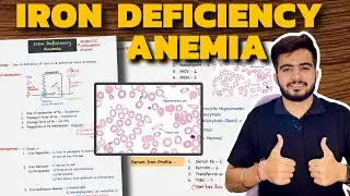 Iron Deficiency Anemia | Hematology | Pathology
