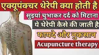एक्यूपंक्चर थेरेपी क्या और कैसे होती है || acupuncture therapy kaise hoti hai || acupuncture therapy