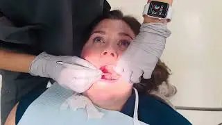 DH How To Do Intra- Oral Exam 2024