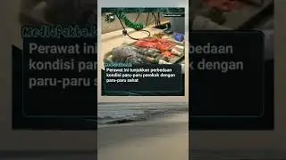 fakta unik paru paru orang perokok dan paru paru orang tidak merokok
