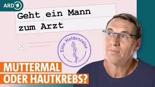 Hautkrebs Screening: Verdächtige Muttermale rechtzeitig erkennen | ARD GESUND