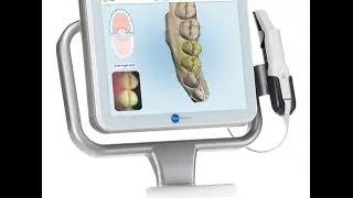 IDS 2017 Intraoral Scanners Review - iTero