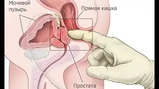 Массаж простаты польза и вред