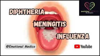 Diphtheria | Meningitis | Influenza | Community medicine