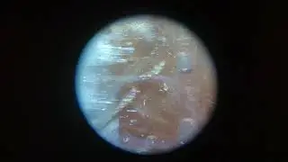 Resin vacuum infusion