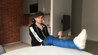 Daniel with his first Long leg cast - LLC