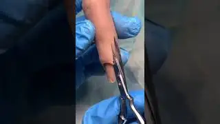I FOUND THIS INSIDE MY PRACTICE FINGER…🤢💅🏼