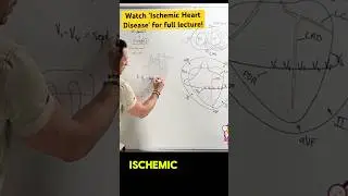 STEMI & ECG!