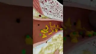 Why Earwax Matters #short #earwax - creativelearning3d