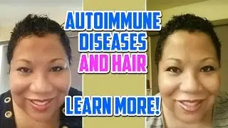 Autoimmune Diseases and My Hair