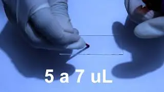 Peripheral Blood Smear Part II