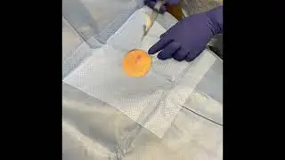 Implanting a Loop Recorder