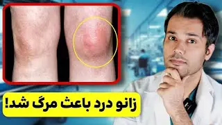 زانو دردی که منجر به یک تشخیص شوکه کننده شد❌️😱علت ترسناک زانو درد این بیمار چی بود؟